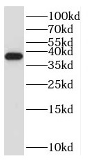 RPP38 antibody|RPP38抗体