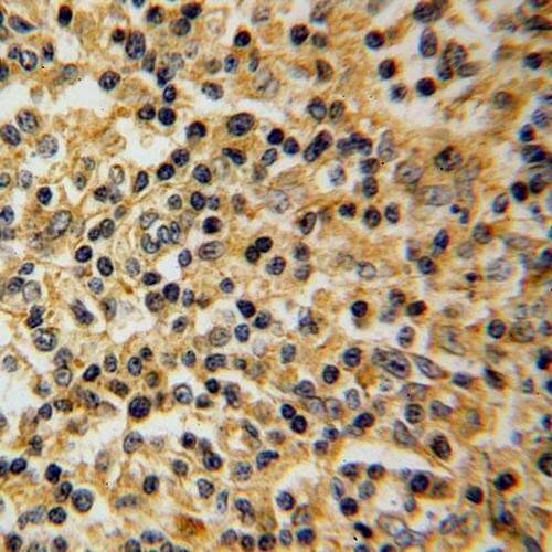 SLC20A1 antibody|SLC20A1抗体