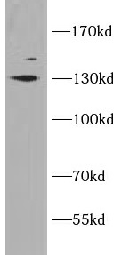 SLC12A4 antibody|SLC12A4抗体