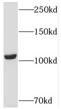 USP33 antibody|USP33抗体 FNab093