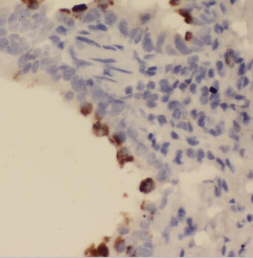 SFTPC antibody|SFTPC抗体