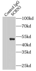 RNF10 antibody|RNF10抗体