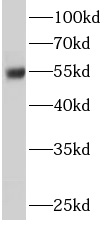ERO1B antibody|ERO1B抗体 FNab028
