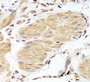 CASP2 antibody|CASP2抗体 FNab012
