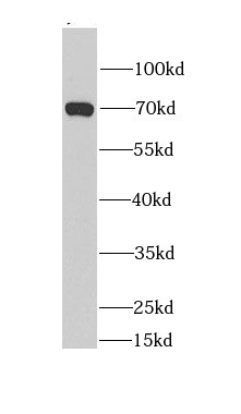BEST1 antibody|BEST1抗体 FNab008