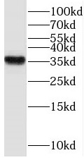 THOC6 antibody|THOC6抗体