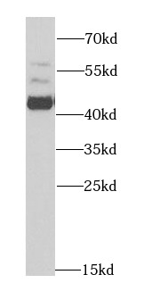 ACY1 antibody|ACY1抗体