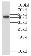 SCARA5 antibody|SCARA5抗体