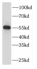 DBNL antibody|DBNL抗体
