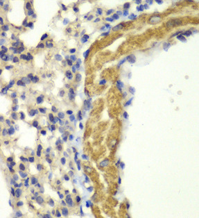 PRKG1 antibody|PRKG1抗体