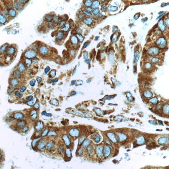 RPS29 antibody|RPS29抗体