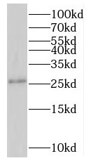 NMNAT3 antibody|NMNAT3抗体