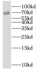SHC1 antibody|SHC1抗体 FNab07839