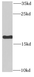 RPLP1 antibody|RPLP1抗体