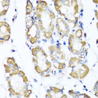 ST6GAL1 antibody|ST6GAL1抗体 FNa
