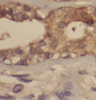 Phospho-VEGF Receptor 2 (Y1175