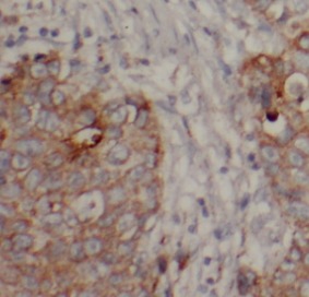 CTNNB1 antibody|CTNNB1抗体 FNab0