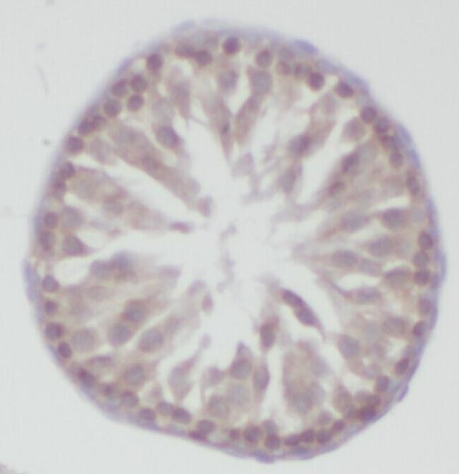 ZNF746 antibody|ZNF746抗体 FNab0
