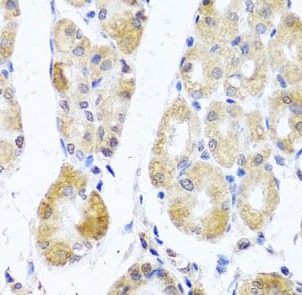 MRPL11 antibody|MRPL11抗体