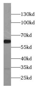 CCKBR-specific antibody|CCKBR抗