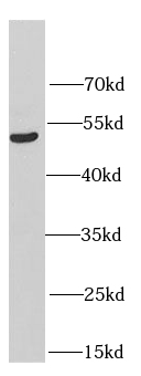 HERPUD1 antibody|HERPUD1抗体
