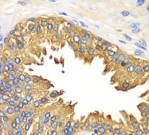 RIGI antibody|RIGI抗体 FNab02317