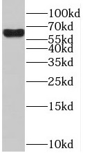 SACM1L antibody|SACM1L抗体
