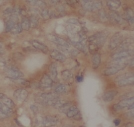 HMGCR antibody|HMGCR抗体 FNab100