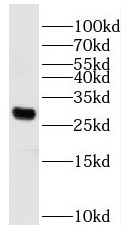 PLPP7 antibody|PLPP7抗体