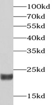 RCVRN antibody|RCVRN抗体