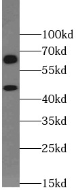 SLC2A2 antibody|SLC2A2抗体 FNab0