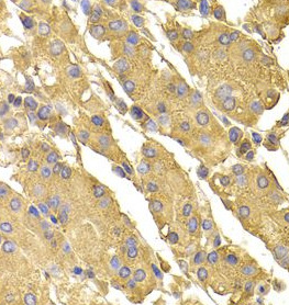 PPP2CA antibody|PPP2CA抗体