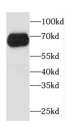 CCDC9 antibody|CCDC9抗体