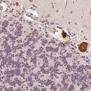 CHTF18 antibody|CHTF18抗体