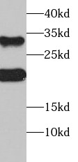 SOST antibody|SOST抗体