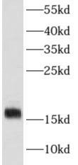 MB antibody|MB抗体 FNab05515