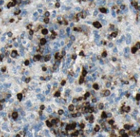 TOP2A-Specific antibody|TOP2A抗