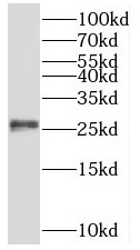 PSMB6 antibody|PSMB6抗体