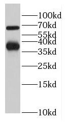LCTL antibody|LCTL抗体