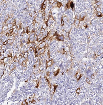 SEC61B antibody|SEC61B抗体 FNab0