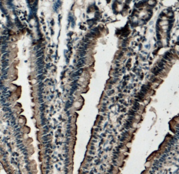 TCN2 antibody|TCN2抗体