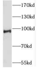 SLK antibody|SLK抗体