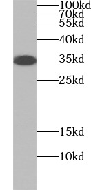 FCGRT antibody|FCGRT抗体