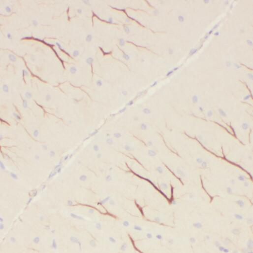 PCDHA5 antibody|PCDHA5抗体