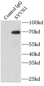 SP1 antibody|SP1抗体 FNab08131