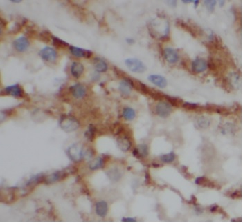 VIPR1 antibody|VIPR1抗体