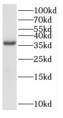 EXTL2 antibody|EXTL2抗体