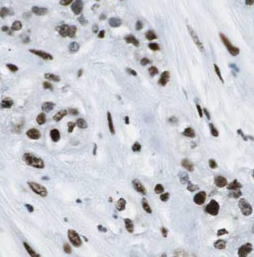 AKAP17A antibody|AKAP17A抗体