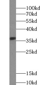 ABHD6 antibody|ABHD6抗体