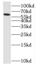 PAK1 antibody|PAK1抗体 FNab06120